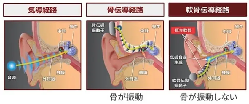 耳を塞がず、クリアな音を。世界初の軟骨伝導イヤホン「サウンドボール®」と首かけ集音器が登場！